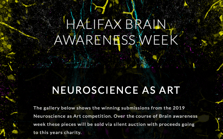 BRCHFX's tweet image. The BRC are delighted to announce the winners of the 2019 Neuroscience as Art competition. Go to hfxbaw.org/neuroscience-a… to see the winners. Better yet, stop by the BRC next week to view the real thing.