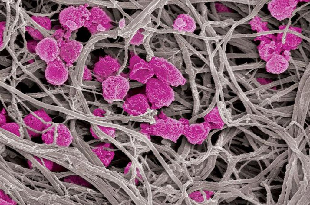BiotechDailycom's tweet photo. Modified Platelets Reduce Risk of Blood Clots and Prevent Metastasis:A promising method for reducing the risk of... https://t.co/Fzg4wLmt6h https://t.co/SZx3DrQEzS
