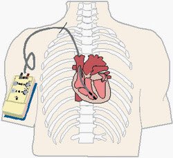 cardiosystemsp's tweet photo. “Uma empresa estimulando seu coração”
#cardiosystemsp https://t.co/ZohExNybL5