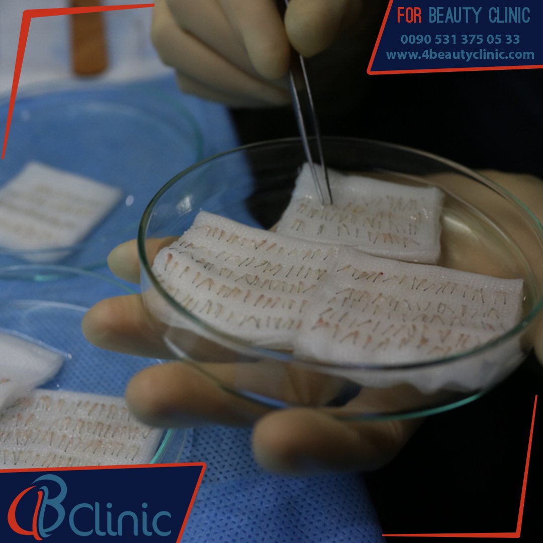 فور بيوتي كلينيك استعد شبابك معنا•
#زراعة_الشعر بأحدث التقنيات
• كادر طبي بخبرات عالية
• عروض مميزة 
#زراعة_اللحية 
#زراعة_الحواجب
#فندق 
#توصيلات 
#ضمان
#البلازما 
#PRP
#ريال_مدريد_برشلونه
.

للتواصل: 00905313750533 📲