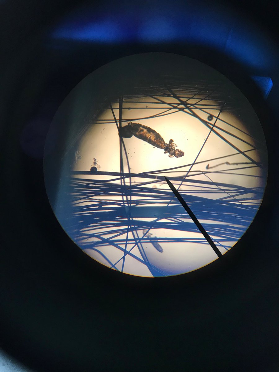 Lice are not nice! An image of sucking lice in a guinea pig under the microscope 🦟 #guineapigs #parasite