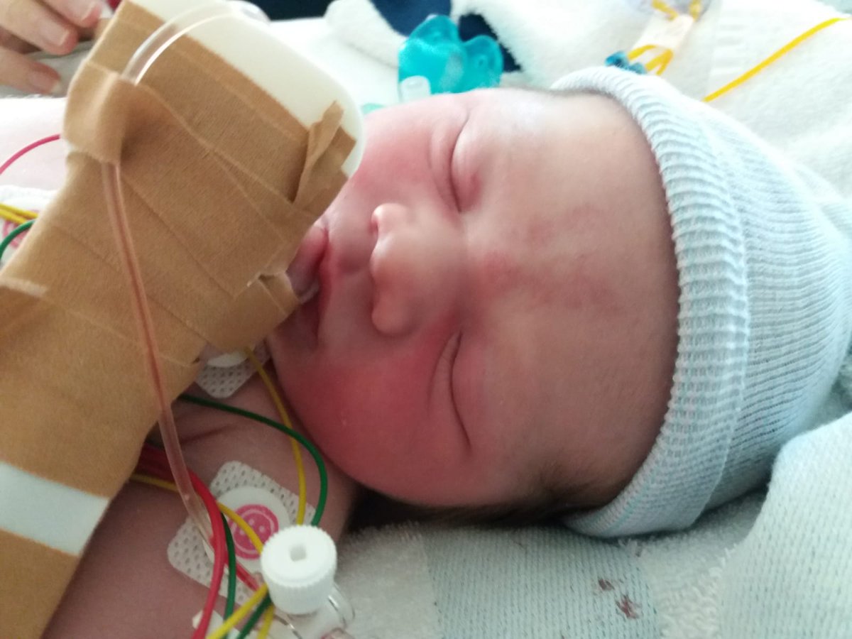 Dit mooie meisje is nu vier dagen oud. Ze heeft een hartritmestoornis waarvoor ze is ingenomen op de intensive care.  Vanaf morgen kan ze niet meer 100% zorg krijgen van mama. Zij heeft nl geen recht om in het ziekenhuis te blijven slapen.  Is dit Nederland? #volongeloof