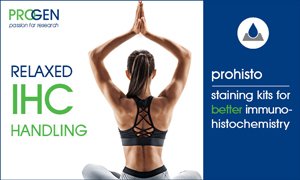 Progen_Biotech's tweet image. prohisto IHC Staining Kits for Relaxed IHC Handling! - mailchi.mp/progen/prohist…