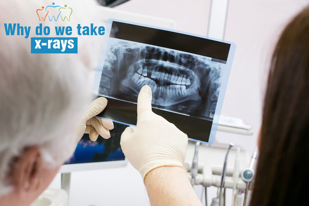 WoononaDentists's tweet photo. Your dentist will take routine x-rays to look for decay between teeth, to check for bone loss, to determine if there is any decay under existing fillings, to look for infection at the tip of the root and to examine an area before treatment is done.
#DentalTreatment  #Woonona https://t.co/rgLXD9zU9l