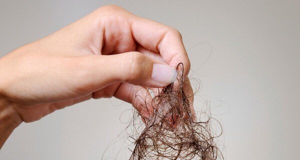 Hair Loss Review on Twitter: 
