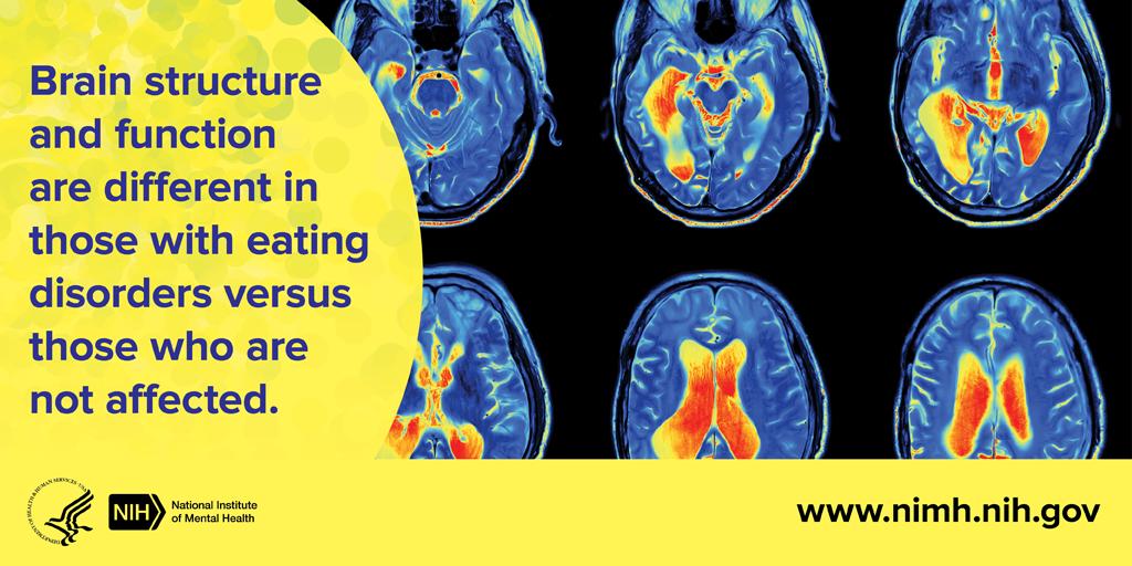 A1: Brain structure and function are different in those with eating disorders versus those who are not affected. #NIMHchats #NEDAwareness