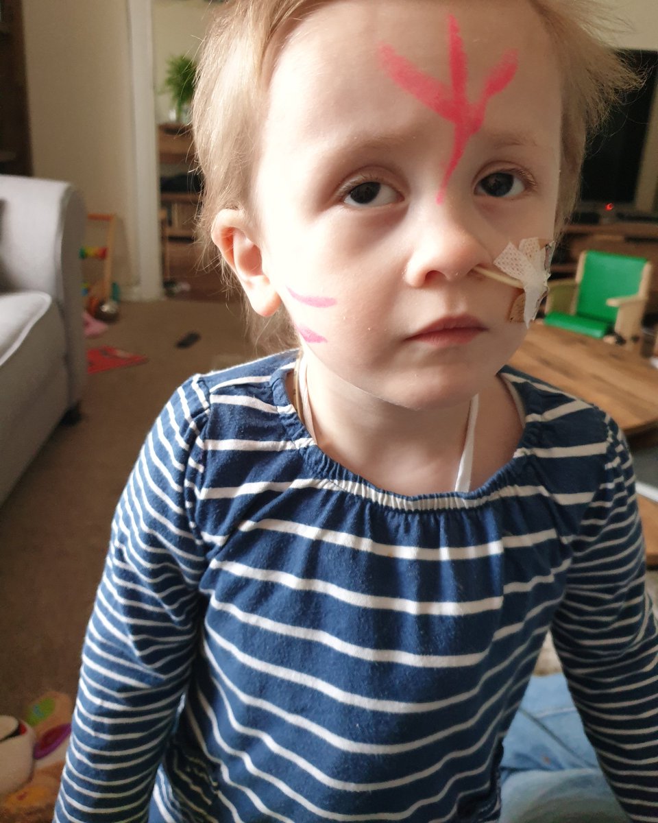 pauljd1985's tweet photo. @TheLastLeg @joshwiddicombe @adamhillscomedy @alex_brooker Day 28 - we've stuck with it until the end, here's Emilia showing her stripes and giving you an unimpressed look 😂 It's #RareDiseaseDay today #isitok to give it a shout out now? #ShowYourRare https://t.co/kv91bcdPNh