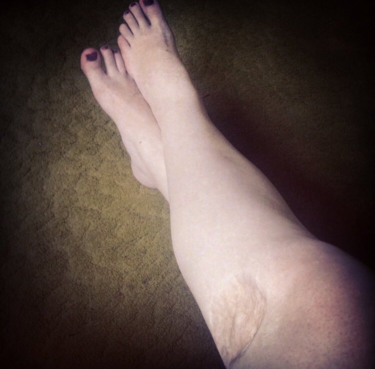 OutlandishlySar's tweet photo. Today I’m celebrating me...celebrating 12 years cancer free - it’s the one anniversary I like to celebrate because I appreciate that still here ❤️ #loveyourscars https://t.co/9MUsNgdU4H