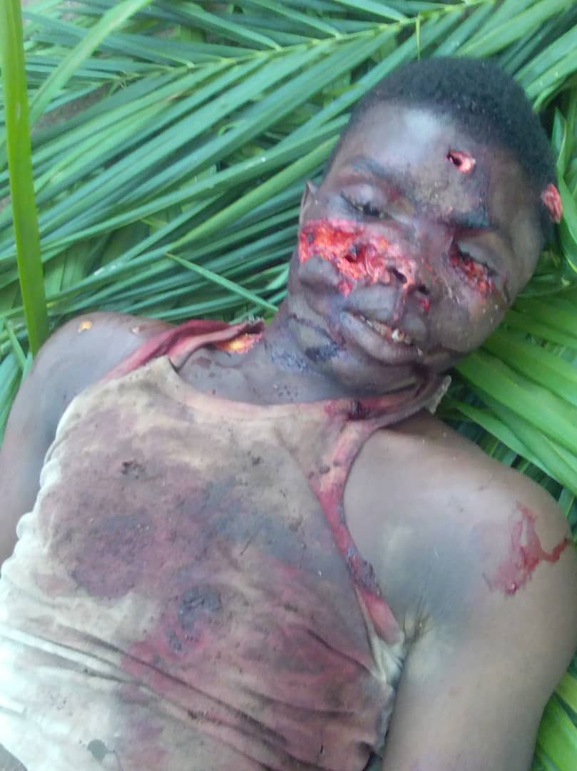 CelestineDingk3's tweet photo. Southern Cameroonians roasted recognition by the wicked forces of la Republique just for being Anglophones! And whole world stays quotes and observe! What what a heartless world!@JNera10 @hrw @amnesty https://t.co/ZLSvg8jtLd