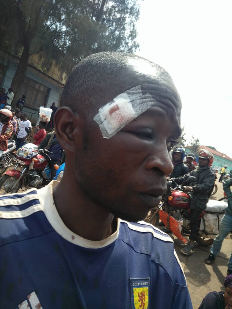 Elie_Fikiri's tweet photo. Monsieur #BILUBI, maire de #Bukavu doit comprendre que le temps de réprimer les manifestations pacifiques est révolu. Il a sûrement bcp à faire que de disperser violemment les paisibles vendeurs des souliers qui réclamaient un espace pour l'étalage de leurs marchandises ce matin. https://t.co/pEdZXl3mwP