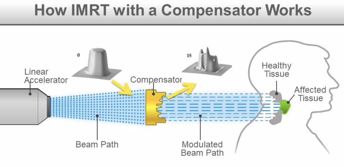 Recyclable compensator-IMRT technology is the solution provided by EmpowerRT to provide affordable IMRT radiation therapy in low-resource clinics. Do you want to be next site to implement this? Feel free to contact us for more information.