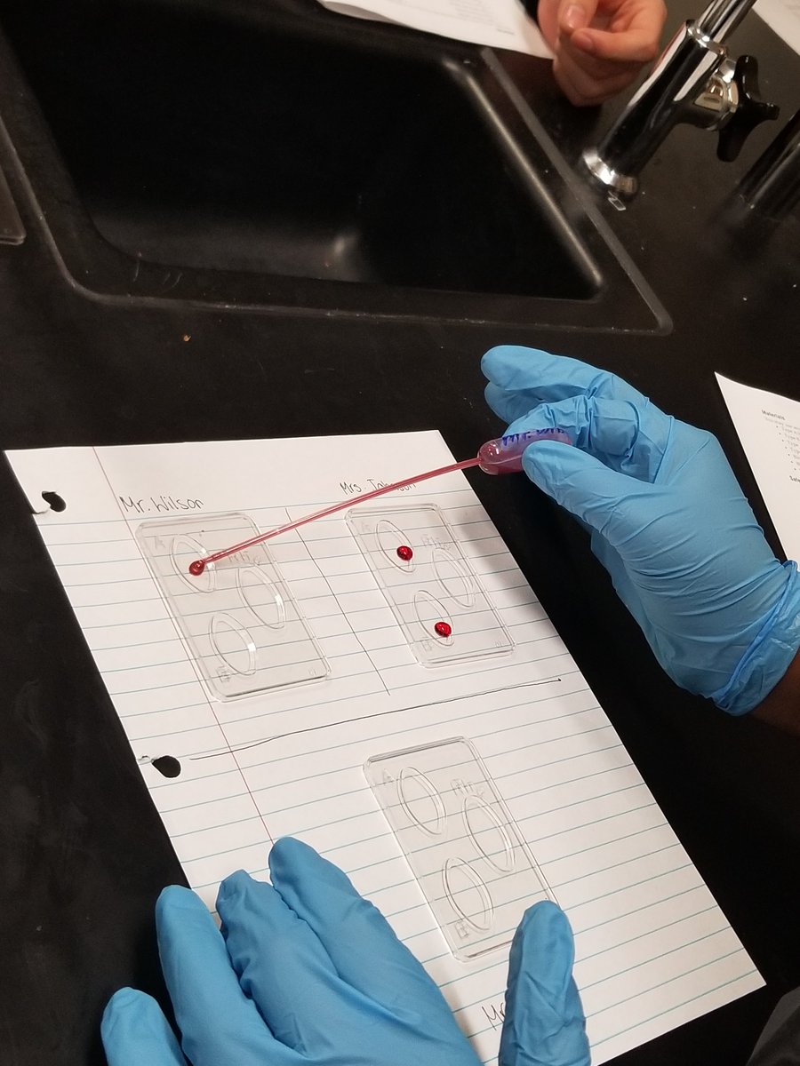 SciTeach618's tweet photo. Engaging students in Biology. #BloodTyping #ADI #Genetics #FocusLesson #InvestigationDesign https://t.co/RJO8md32e5
