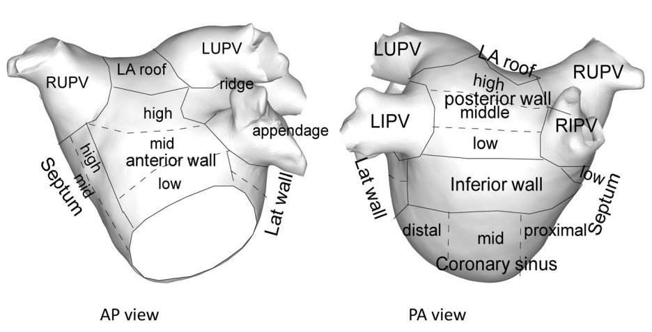 Left atrial segmentation for left-sided catheter ablation
(CAE 2012;5:351-360). <a href="/MDTolgaAksu/">Tolga Aksu, MD</a> <a href="/DrSerdarBOZYEL/">Serdar Bozyel, MD</a> <a href="/AlperDra/">Ahmet Taha Alper</a> <a href="/Basarcand/">Basar Candemir</a> <a href="/aalahmadmd/">Amin Al-Ahmad, MD</a> <a href="/LuigiDiBiaseMD/">Luigi Di Biase</a> @andreanatalemd <a href="/Prof_Schilling/">Richard Schilling</a>