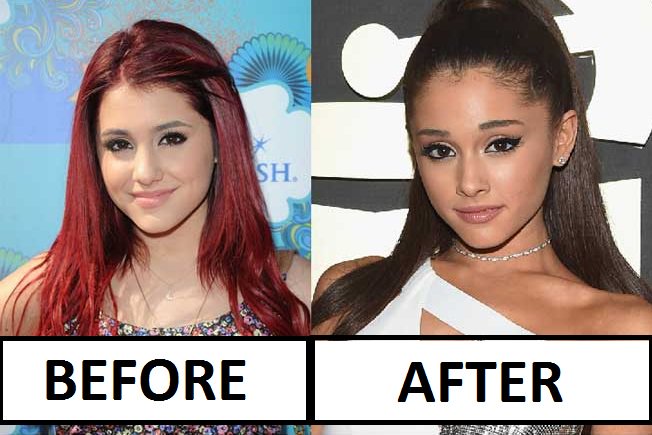 Ariana Grande Plastic Surgery