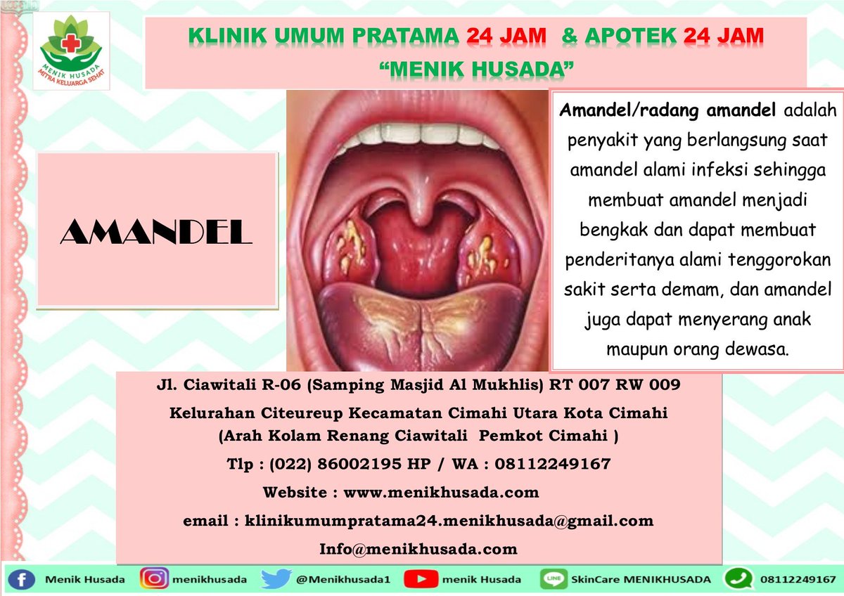 Menikhusada1's tweet photo. Selamat Malam sahabat Menik Husada
Radang tenggorokan ini hampir pernah dialami siapa saja. Namun perlu diketahui yaa sahabat Menik, bahwa fungsi amandel yaitu mendukung sistem imun tubuh dengan melindungi tubuh dari serangan infeksi yg akan masuk menyerang tubuh melalui mulut. https://t.co/jJfSOQPIJY