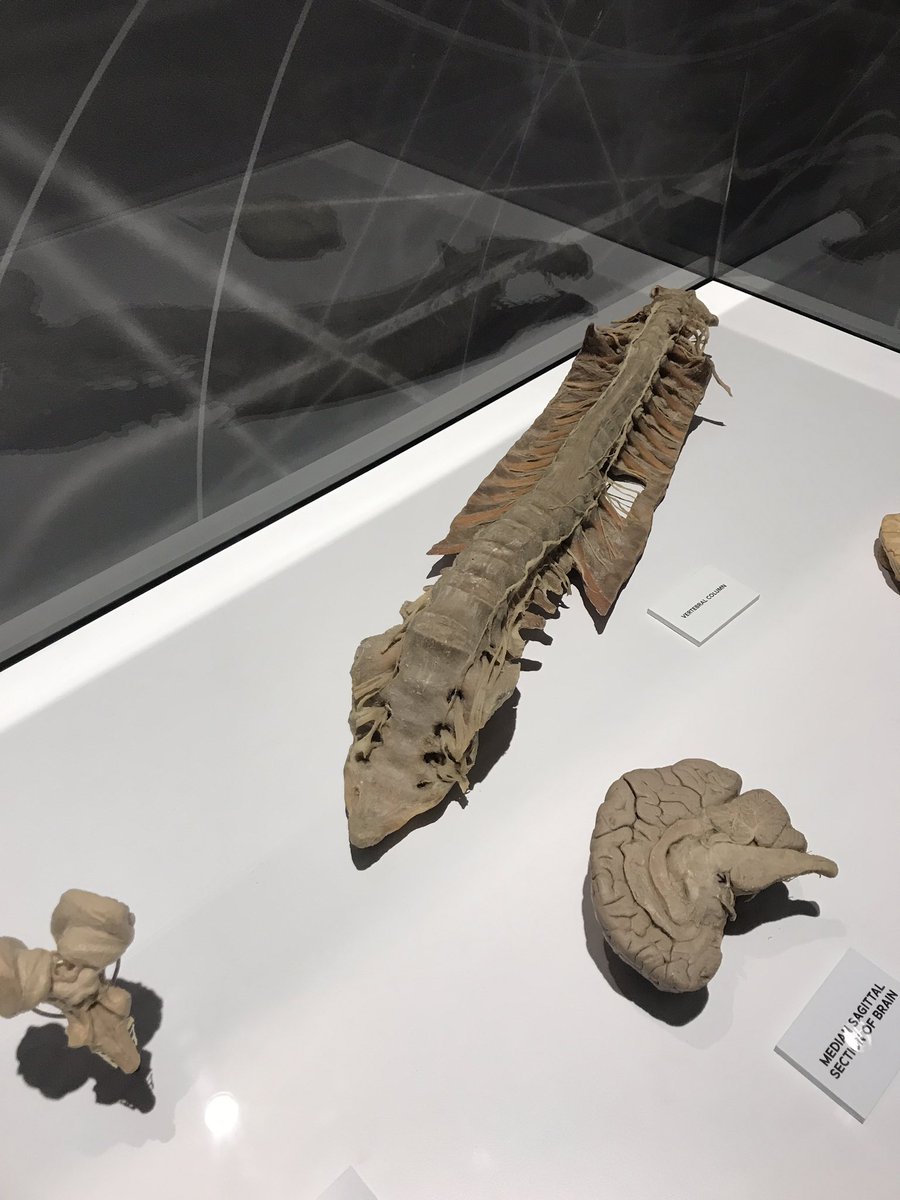WHolland87's tweet photo. Adult vertebral column / spinal cord nerve system . Looks pretty DURAble. Get it? #healthcarejokes https://t.co/aXbXWw1LvM