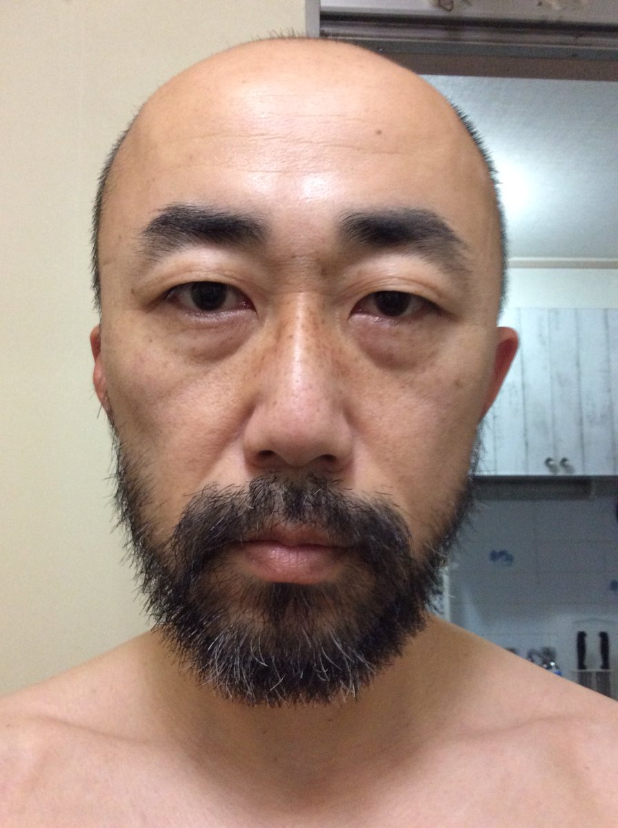 池田毅 Ip企画 眉毛以外 全部剃りましたよw ほぼ 産まれたままの姿ですw 全身写真載せたら捕まりますww 池田毅 Ip企画 眉毛以外 全部剃りましたよw ほぼ 産まれたままの姿ですw 全身写真載せたら捕まりますww