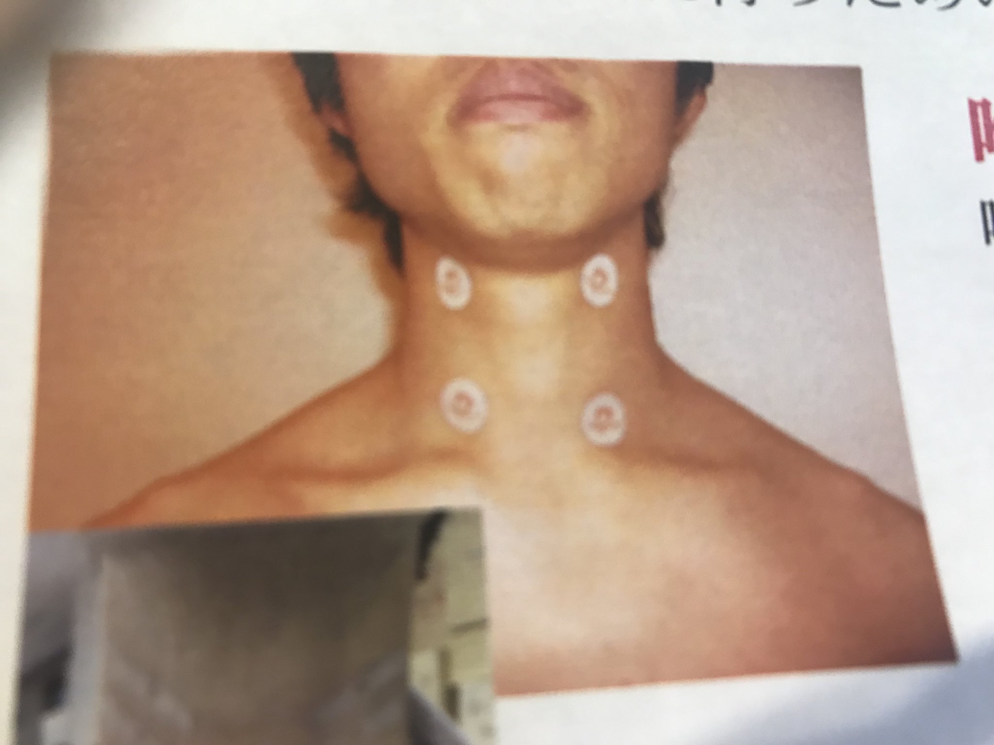 ファイテン ランニング ライフ Na Twitteru 2 28 木 から昨日までの東京マラソンexpo ファイテンブースには大勢のランナーの方にご来場頂きました ありがとうございました ブースではチタンテープの貼り方やセルフボディケアをご提案させていただきました