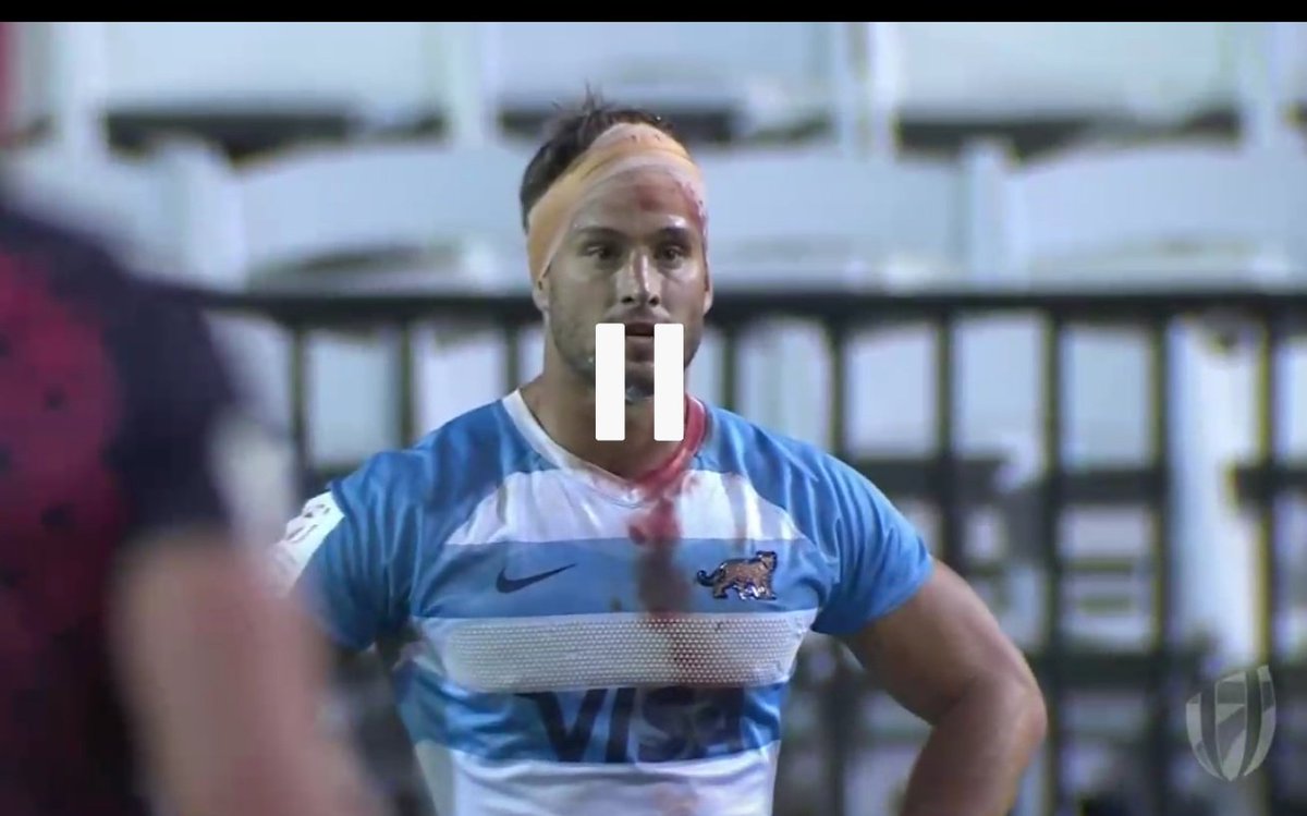 #USA7s #Rugby

📷 Envuelto en sangre terminó @nitoproven. Una muestra de lo que son #Pumas7s 

A pesar de las lesiones de Moroni y Revol, la baja de Roura + la ausencia de Los Pumitas este equipo se reinventa en cada torneo