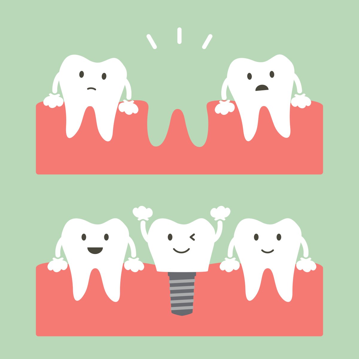 Missing something? Here at The Briars Dental Centre, we have lots of different options to replace a missing tooth, including dental implants! If you would like to have a chat about your options, give us a call on 01635 40311.

#tooth #implant #briarsdentalcentre