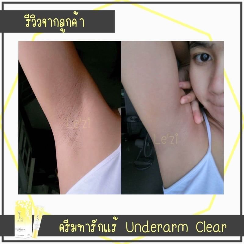 mfh2723k's tweet photo. ❥รักแร้เนียนขึ้น 
-ทาปุ๊ป ใส่เสื้อทับได้เลย ไม่ต้องรอแห้ง สะดวกสุดๆ
.
❥ใช้แล้วเห็นผลจริง‼️
รีวิวสดๆร้อนๆจากลูกค้า🌿
.
•รักแร้ขาว •ลดตุ่มหนังไก่ •ระงับกลิ่น
•ทาตรงไหนขาวตรงนั้น •ใช้แทนโรลออนได้เลย 
. 
หลอดละ 129฿
#ครีมรักแร้ขาว #เลอซี่  #Lezi

https://t.co/vMXSKjxtmN https://t.co/PjxOYodjcs