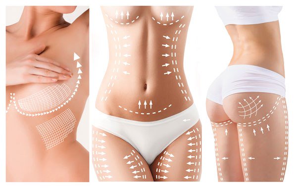 SurgeryDash's tweet image. About Cosmetic surgery dashplasticsurgery.wordpress.com/2019/03/03/abo…