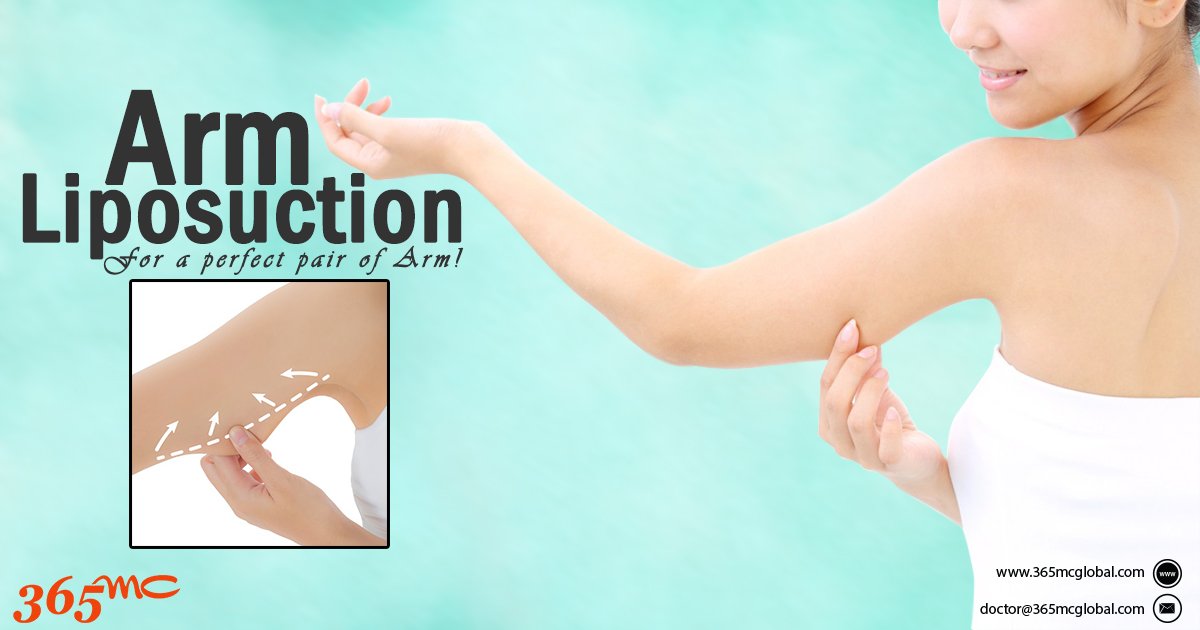 To remove your Sagging arm you can totally rely on #365mc_global. #Arm_liposuction makes your body more attractive and makes you more confident!
To know more
Web site: 365mcglobal.com
Youtube: bit.ly/2SAb2jz
#armliposuction
#365mcglobal 
#plasticsurgery 
#korea