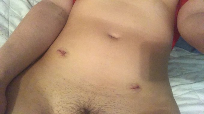 😌finally home, surgery went great&amp; I&rsquo;m feeling a lot better! Tbh; ALL OF YOU GOT ME THROUGH IT💖 LOVE<a href="/tag/mvsales"class="tags"><span>#mvsales</span></a>