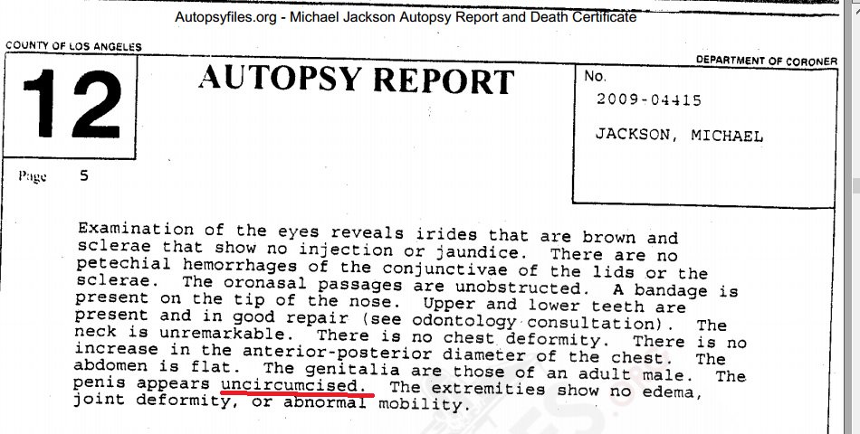 Oh my gaaahd. If this is the drawing, it's true and further confirmation of what P.I. Scott Ross said.   https://www.reddit.com/r/videos/comments/1yh5c8/michael_jackson_goes_shopping_in_las_vegas/cfl8vy2/Jackson's autopsy report says 'uncircumcised' (which prob means anybody who makes an allegation now will know. -_- )  #leavingneverlandI'm...