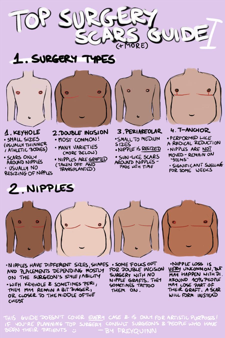 nathaniel on Twitter: "TOP SURGERY scars(+more) guide ✨ i have seen very few on drawing chests that have undergone top surgery &amp; the few i've were very flawed, so now