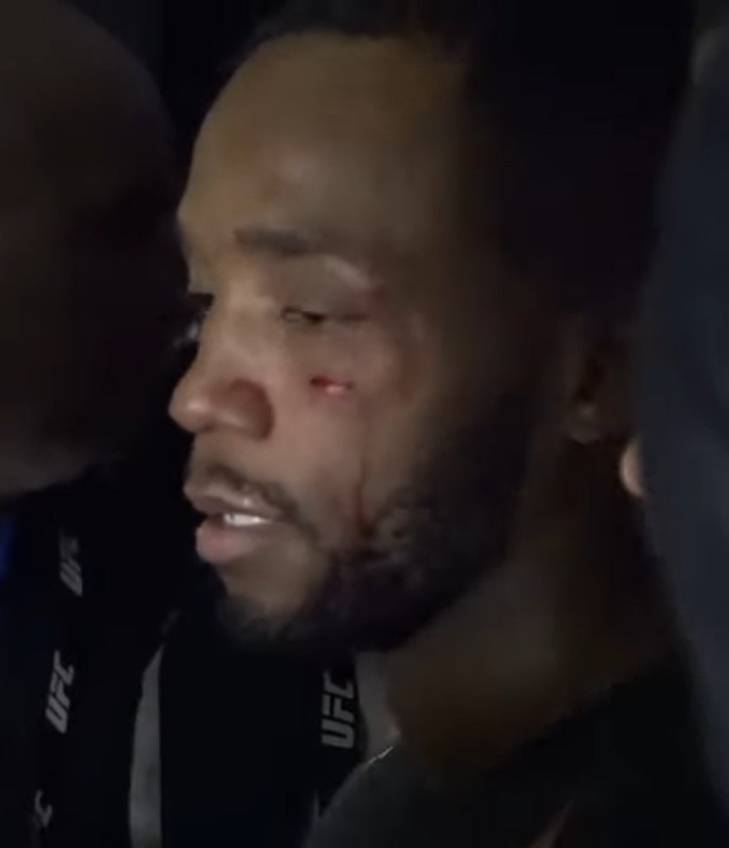 ChamatkarSandhu's tweet image. Here's a much longer video of the Jorge Masvidal / Leon Edwards altercation backstage at the o2 arena. Edwards recieved a pretty nasty cut under his left eye. #UFCLondon
youtu.be/yW4FafSnhxA