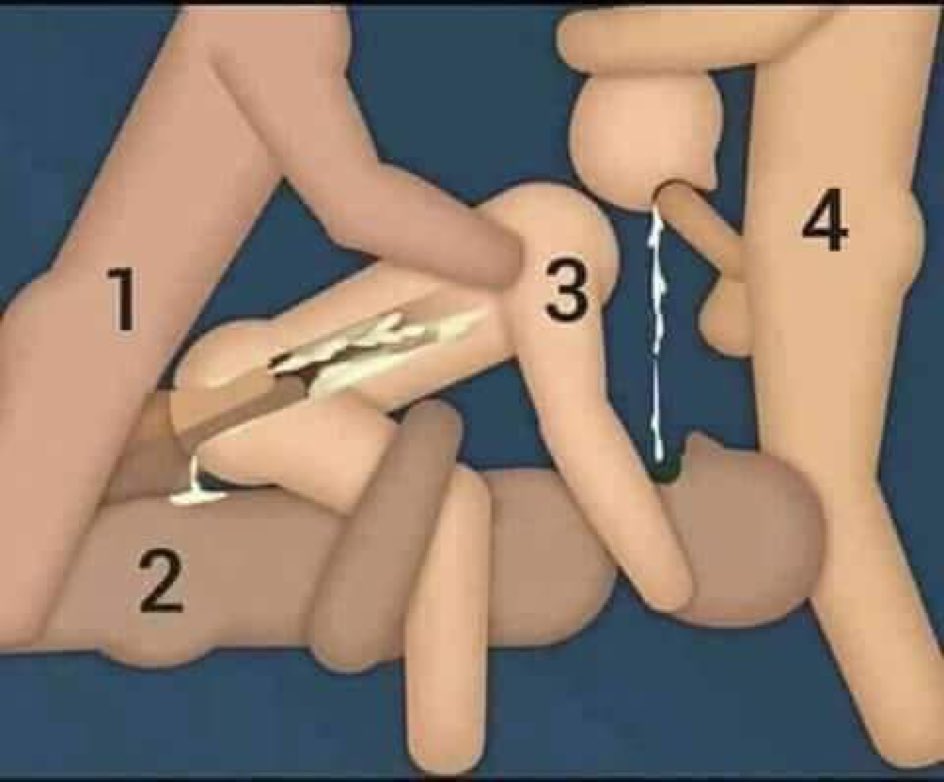 #antalyapasif hangisi olmak istersiniz😄