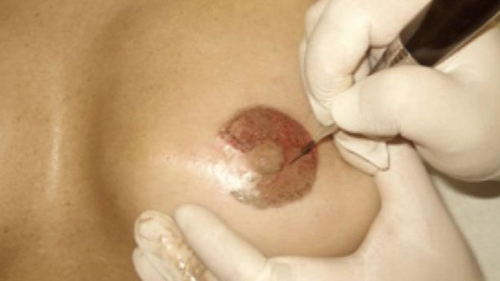 "Tatuaje solidario", el 'tatoo' al servicio de la recuperación de la feminidad | Más info ℹ️ csur.red/sZcP30o4KvC