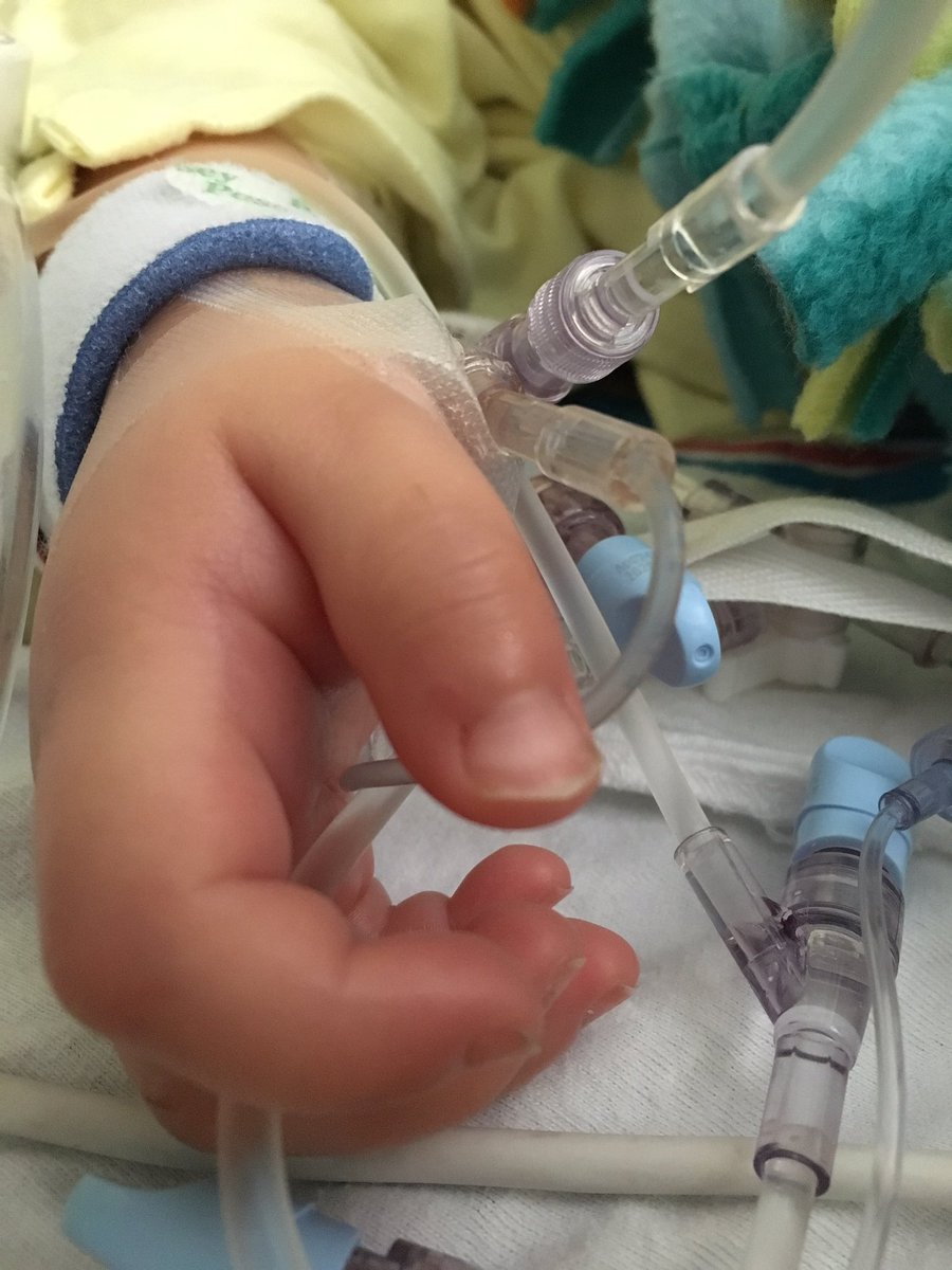 TeamNaaman's tweet photo. Stable but still in the PICU with a log way to go. My tough little guy #TeamNaaman #ChildhoodCancer #ChildhoodCancerAwareness @Buffalonian83 https://t.co/iKRGDDHoDm