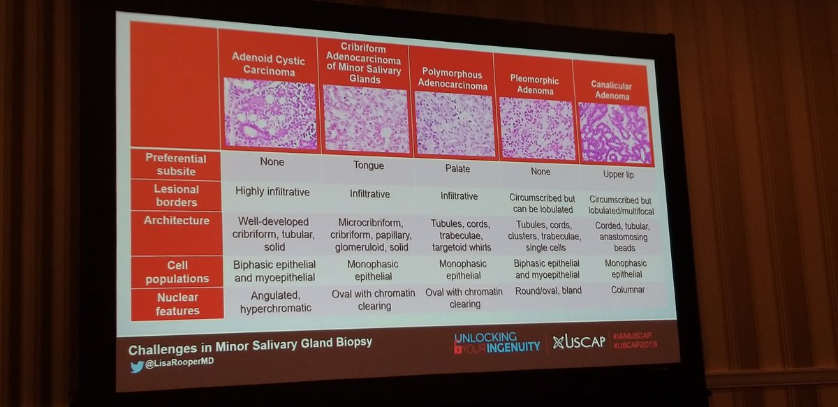 HeadandNeckPath's tweet photo. Great table for minor salivary gland biopsies by @LisaRooperMD at the NASHNP meeting #USCAP #NASHNP #Headandneckpath https://t.co/hSk4tOli7j