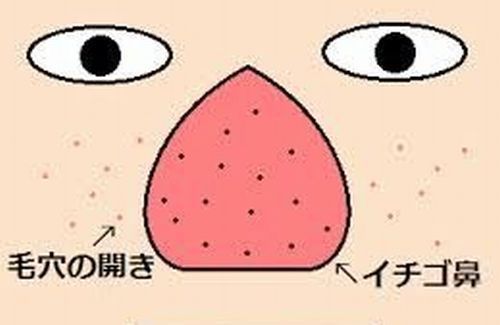 いちご鼻のtwitterイラスト検索結果