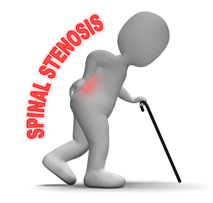 Spine2019's tweet photo. Stop suffering from #arthritis and #spinal #stenosis, Total Health Chiropractic is here to help #Neck or #Back #Pain #Radiating #Pain #Spinal #Joint 
https://t.co/zCN7w29Oh1 https://t.co/rxQAKovV64