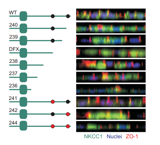 AJPCellPhys's tweet photo. Koumangoye et al's new study reported the first known SLC12A2 #mutation that causes #epithelial dysfunction in an undiagnosed #diseaseprogram case. Read full research paper #PublishedinAJPCell. https://t.co/mZxUM7tLO9 https://t.co/4vEkbKmSLb