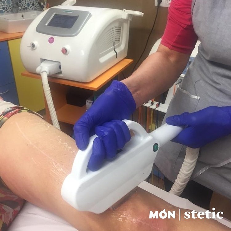 Mon_Stetic's tweet photo. Cada vegada més homes decideixen acabar amb el pèl del seu cos. A Món Stetic, comptem amb la millor tecnologia en fotodepilació. Informa't !!! #monstetic #depilacion #fotodepilacion #estetica #santboi #igualada #camesdepilades https://t.co/qR57ywGGqv
