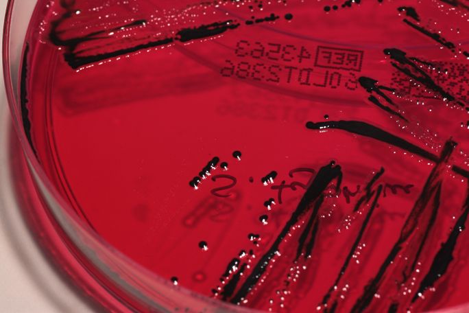xld agar results xld agar results