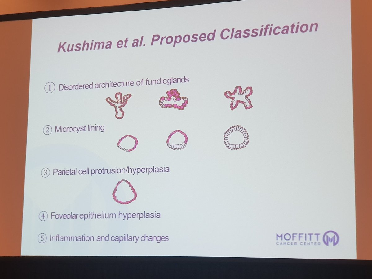 GeronimoJrLapac's tweet photo. Nice study ! Fundic Gland Polyps
#USCAP2019 #pathology #GIpath https://t.co/Ne8vYBaIy1