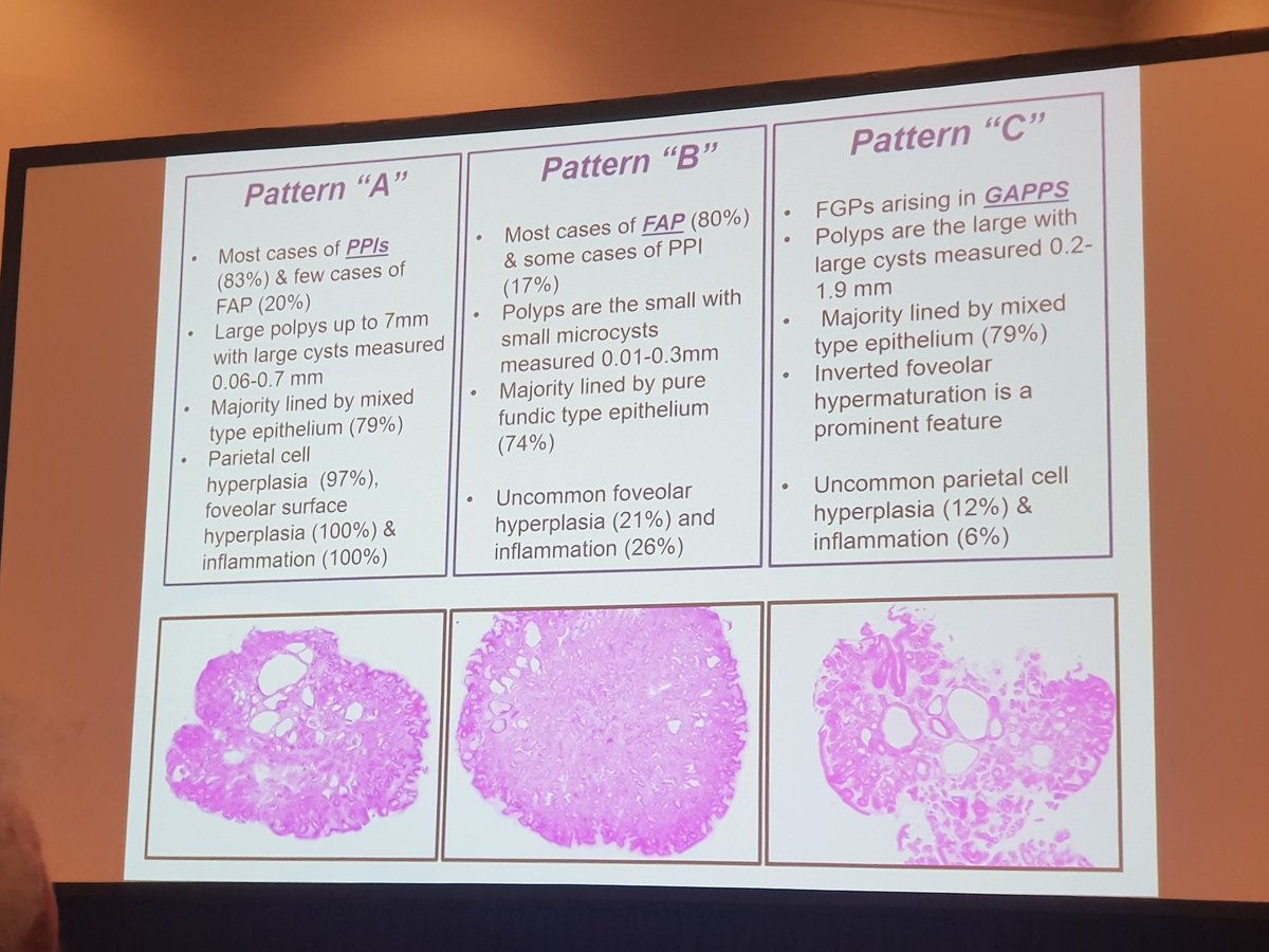 GeronimoJrLapac's tweet photo. Nice study ! Fundic Gland Polyps
#USCAP2019 #pathology #GIpath https://t.co/Ne8vYBaIy1