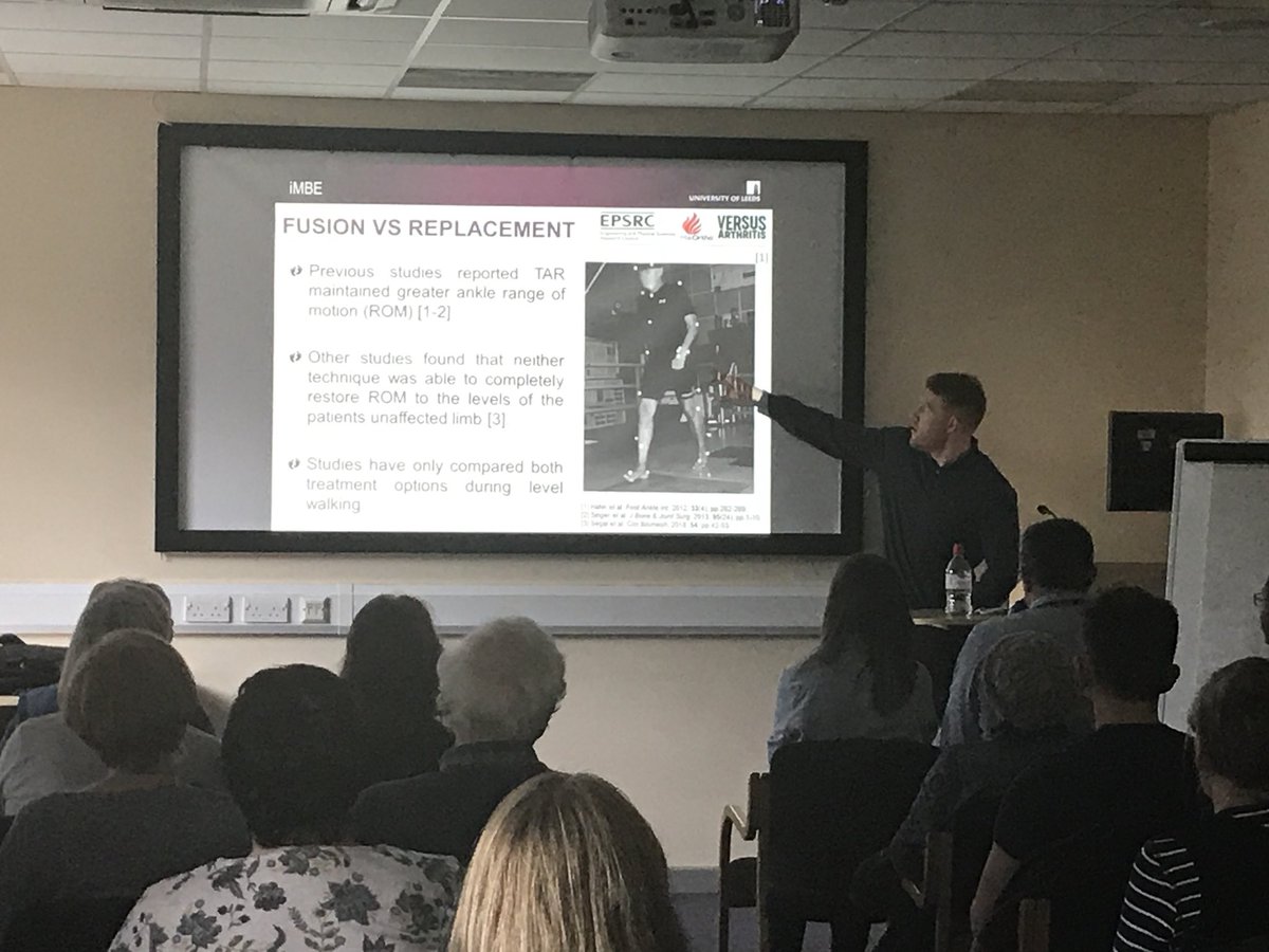 @JamesHopwood93 from @iMBE_Leeds Exploring the difference in functional outcomes between #Anklereplacement & #Anklefusion #Gaitanalysis #Whywedoresearch