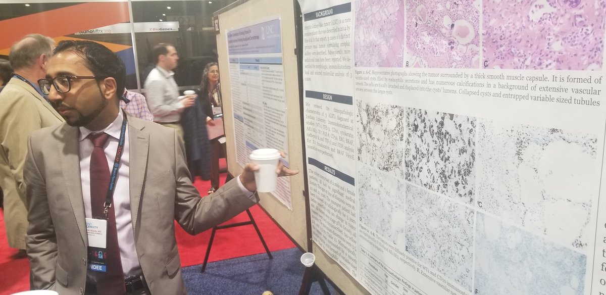 MJMagersMD's tweet photo. @KhaleelAlObaidy presenting a very rare interesting kidney tumor: Atrophic Kidney-Like Tumor #gupath #kidneycancer #iupath https://t.co/BRaYzJo05n