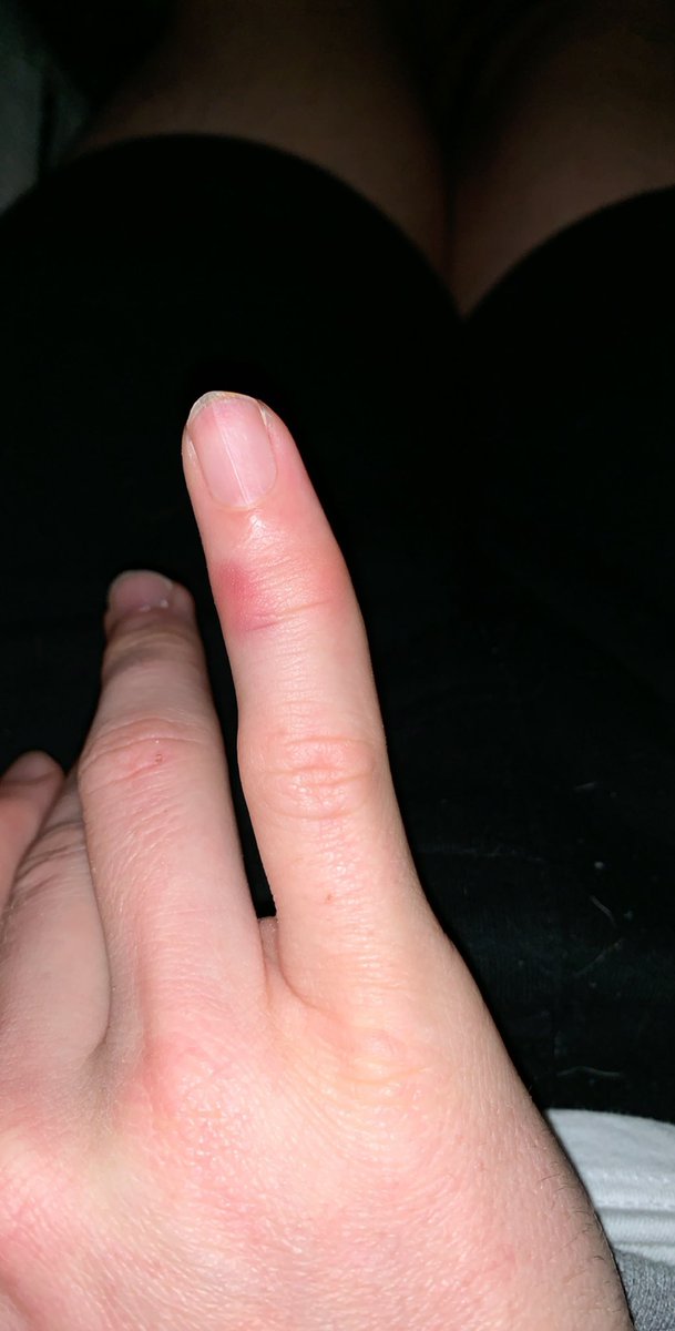 James Norwood tweet media