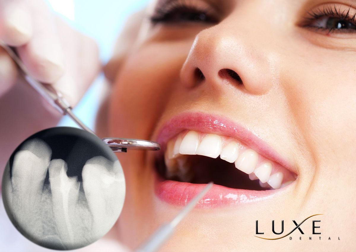 Dental Care Tips That You Need To Know

Did you just break your tooth? The first thing that you need to do is get in touch with your dentist. After, rinse your mouth out with warm water. Then use a cold compress on the area to reduce the swelling and decrease any pain.