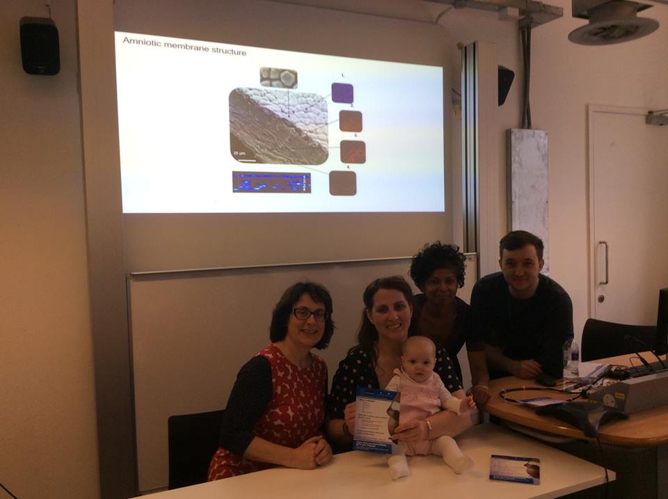 PpromAwarenessU's tweet photo. #InternationalWomensDay2019 inspiring doctors,researchers & volunteers making a difference to #PPROM in pregnancy @PpromAwarenessU @ttchowdhury @PrenatalTherapy @LiverpoolWomens
#Stemcells
https://t.co/lqKY68hzjc
& #UKOSS study
https://t.co/5emRFXoelF
@RCPI_ObsGyn #MatExp https://t.co/iNsBra31i3