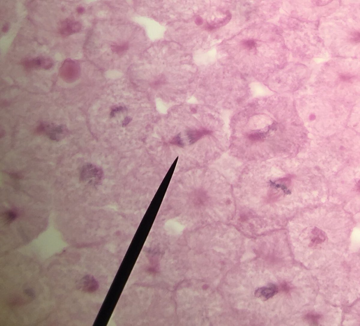 BlaiseM10's tweet photo. @UNKBiol106AC This week in lab we looked at different phases of mitosis in different kinds of cells. #106Week9ACS19 https://t.co/rWNiS5lqAP