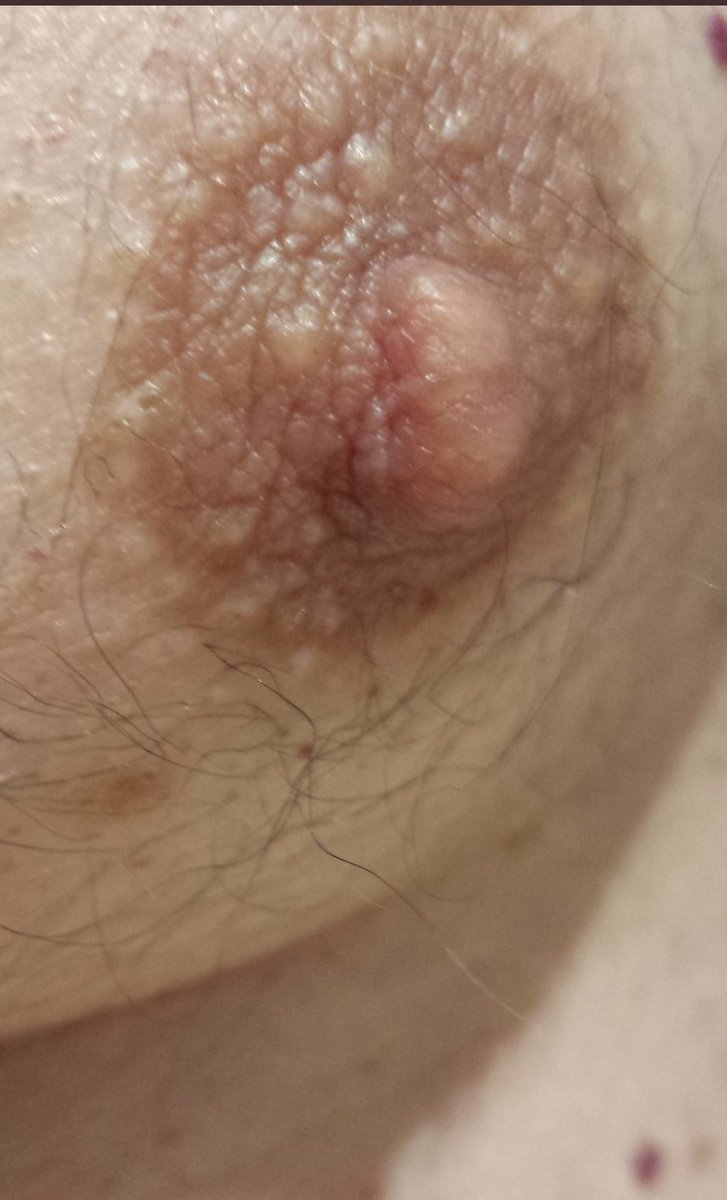 hanonymex's tweet photo. Vous voulez voir la définition même d'une maladie, d'un virus ? Voila c'est ça un pestiferer, une lopette, une merde sale, une souillure
#moneyslave #feetish #moneymiss #lopette #fuckyoupayme #piggeswanted #paypig #findom #findomme #smokingfestish https://t.co/VRNShUhBKY