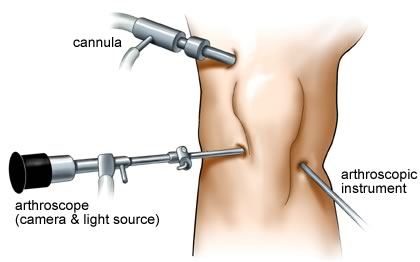 free inertial fusion energy target injection